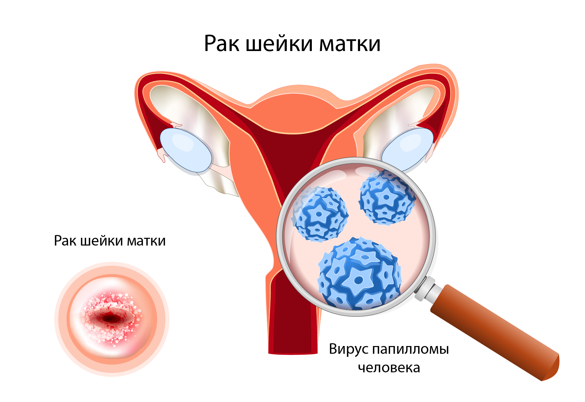 влияние спермы на шейку матки фото 3